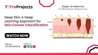 DeepSkin A Deep Learning Approach for Skin Cancer Classification
