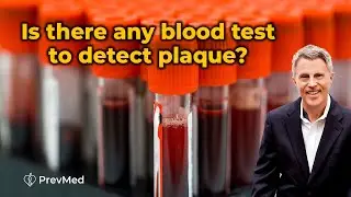 Is there any Blood Test to Detect Plaque?