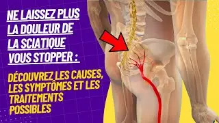 Comprendre la douleur de la sciatique : tout ce que vous devez savoir