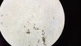 Fish internal parasites - Capillaria worm eggs under the microscope