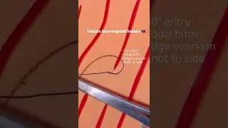 Most commonly used basic suture technique&hellip;#surgeon #surgery #surgicalknots #suturing #skills #clinic