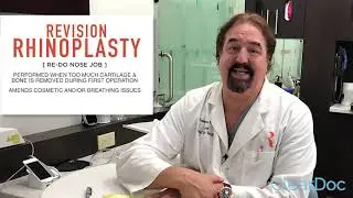 What is Revision Rhinoplasty?