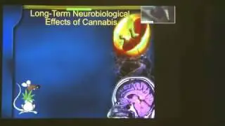 The Vulnerable Brain  Insights into the Neurobiology of Addiction. Yasmin Hurd (2014) HD