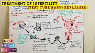 Treatment of Infertility & Test Tube Baby Explained | Class 12 Biology 