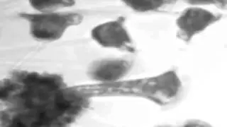 dueling ciliates