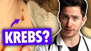 Hast Du Krebs ohne es zu merken? (10 deutliche Zeichen)