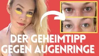AUGENRINGE AD&Eacute;! Dieses Hausmittel l&auml;sst dunkle Schatten nat&uuml;rlich verschwinden!