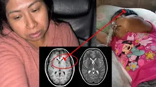 NUNCA IMAGINAMOS que esto TIENE en la CABEZA‼️😭😭
