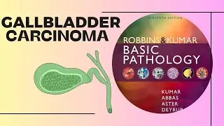 Gallbladder Carcinoma  | Causes, Pathology & Key Facts | Robbins 11th Edition