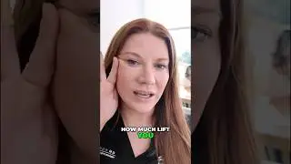 Deep Plane Facelift EXPLAINED