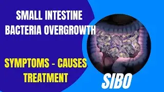 SIBO | Small Intestinal Bacterial Overgrowth | Causes | Symptoms | Treatment Steps