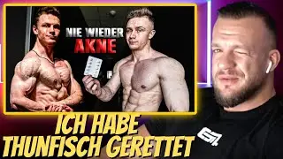 Ich habe Thunfisch von seiner Akne befreit! Dankt mir später. William Niewiara Live Reaktion