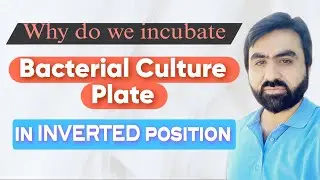 Why do we incubate Petri Plate in Inverted Position | Bacterial culturr plate in inverted position |