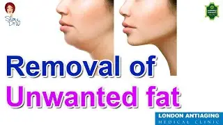 Removal of unwanted fat