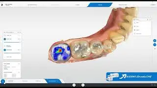 Katana Zirconia One: Workflow