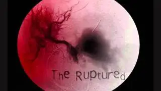 Ruptured  