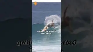 Surfer gets bitten by shark twice on same beach, 11 years apart #shorts
