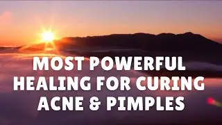MOST POWERFUL HEALING FOR CURING ACNE /PIMPLES & SCARS...