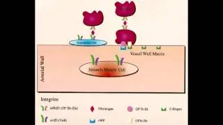 Platelet Disorders - Bernard Soulier Syndrome & Glanzmann's Thrombasthenia