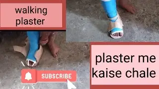 plaster ke sath kaise chale # plaster shoes #vlogger #dailyvlog