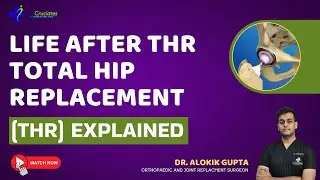 Total Hip Replacement (THR) के बाद ज़िंदगी | Life After THR Explained | THR के बाद Normal Life?