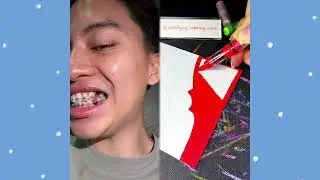 #pov #skit #funny #acting #story#fyp #foryou#foryoupage #fypシ #fypage #duet #viral #tools