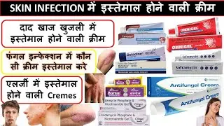Skin Infection में इस्तेमाल होने वाली Creme | Antifungal | Allergy Cream | Treatment | Doctor 