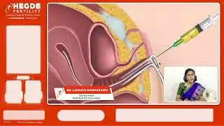 What is PGT-A? Get full details! | Top Infertility Hospital in Hyderabad #HegdeFertility