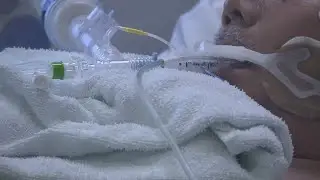 Training the breathing muscle after Covid; Study shows damage in patients but repair is possible