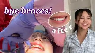 GETTING MY BRACES OFF (FINALLY!) | Philippines