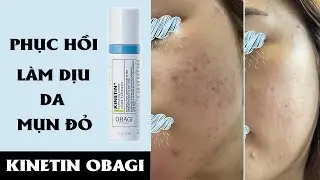 kinetin obagi -  kem dưỡng kinetin obagi review - Tờ Hi Skincare