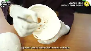 ANATOMI 6   SYSTEMA SKELETALE   SKELETON AXIALE Neurocranium