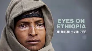 Ethiopia Eye Crisis: help us beat trachoma and permanent blindness today