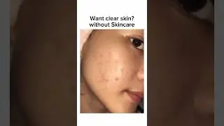 How to fix Your Bumpy Skin FAST! 🌸 Easy Remedy for Smooth, Flawless Skin #bumpy #diyskincare