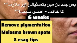 Remove Pigmentation & Melasma | Get Rid of Dark Spots Naturally | 2 Easy Tips