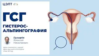 Как при бесплодии и других патологиях помогает ГСГ &mdash; гистеросальпингография.