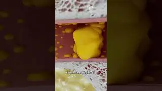 Как правильно удалить ушную серную пробку #шорты #факты - creativelearning3d