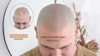 Is this the end for shiny bald heads? #zeroshine #baldhead