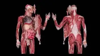How Are Human Body Parts Permanently Preserved?