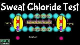 Sweat Chloride Test | Sweat Test For Cistic Fibrosis |