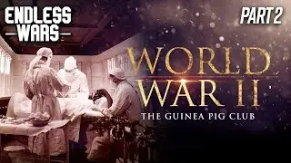 The Guinea Pig Club | WWII Documentary