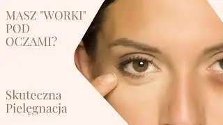 SPOS&Oacute;B NA WORKI, ZMARSZCZKI, OBRZĘKI I CIENIE POD OCZAMI 👀🫣