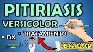 PITIRIASIS VERSICOLOR TRATAMIENTO Y CAUSAS | Diagnóstico ( Dermatología ) 📝👨🏻‍⚕️ EXPLICACIÓN FÁCIL⚡