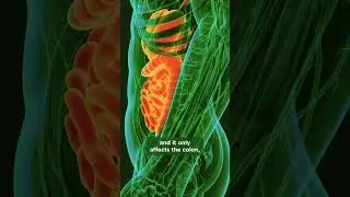 Q&A with a gastroenterologist: Diet and IBD