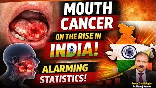 Mouth cancer incidence very high  in india - Gutka & alcohol main reason ! With Dr. Manoj Kumar