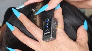 Ultimate Scalp Scratch Comfort ASMR 💆&zwj;♀️✨ | Long Nails, Flake Detail & Pure Relaxation #DN521
