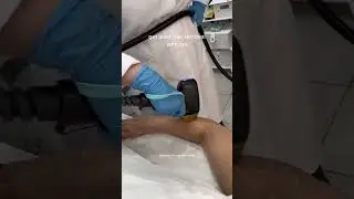 Laser Hair Removal at Mayfair Aesthetics London