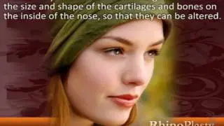 RhinoPlasty Guide #2
