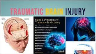 traumatic brain injury | traumatic brain injury in hindi | trauma & brain @PhysiotherapyKnowledge