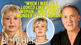 ОТВЕРГНУТО компанией Botched: подтяжка лица в Мексике привела к НЕобратимому повреждению нервов и...